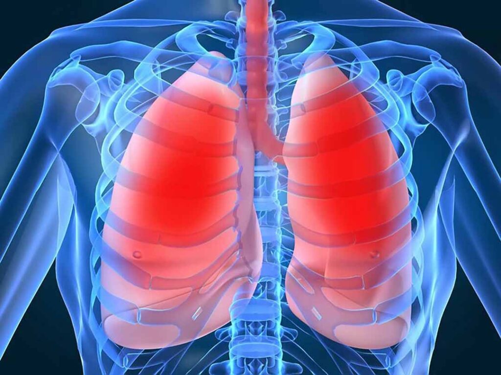 Nỗi sợ bệnh lao phổi của người cao tuổi và cách phòng bệnh