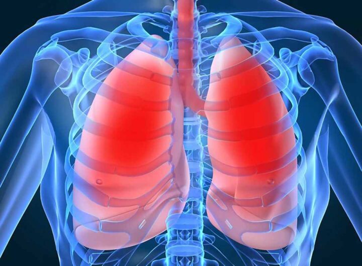 Nỗi sợ bệnh lao phổi của người cao tuổi và cách phòng bệnh